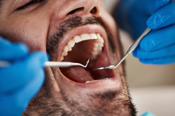 Best Emergency Treatment for Dental Infections or Abscesses in Lititz, PA
